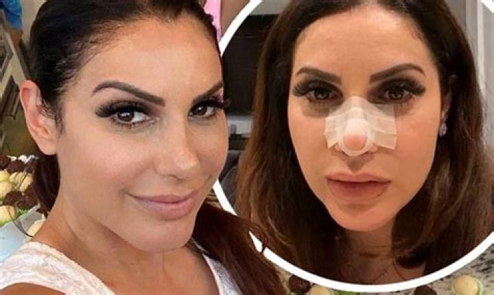 RHONJ star Jennifer Aydin shows off the results of plastic surgery after nose job and chin implant